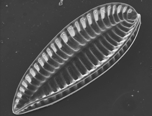 Iconella splendida Ehrenb., scanning electron microscope image by RG Diatomeen, Bo Berlin